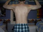 rebackflex2.jpg
