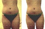 goal-frontal.JPG