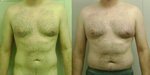 Before and After.JPG
