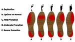 supination.jpeg