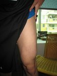 leg before.jpg