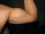 arm before 03.jpg