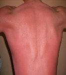 espalda to kema....JPG