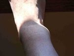 ankle.jpg