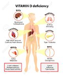 42801714-vitamin-d-deficiency-symptoms-and-diseases-caused-by-insufficient-vitamin-d-symptoms-...jpg