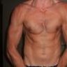 nolito