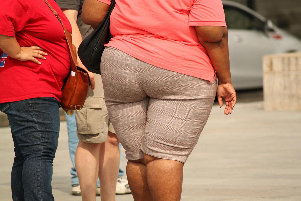 Why on Earth Do We Get Obese? Exploring the Modern Causes of Obesity