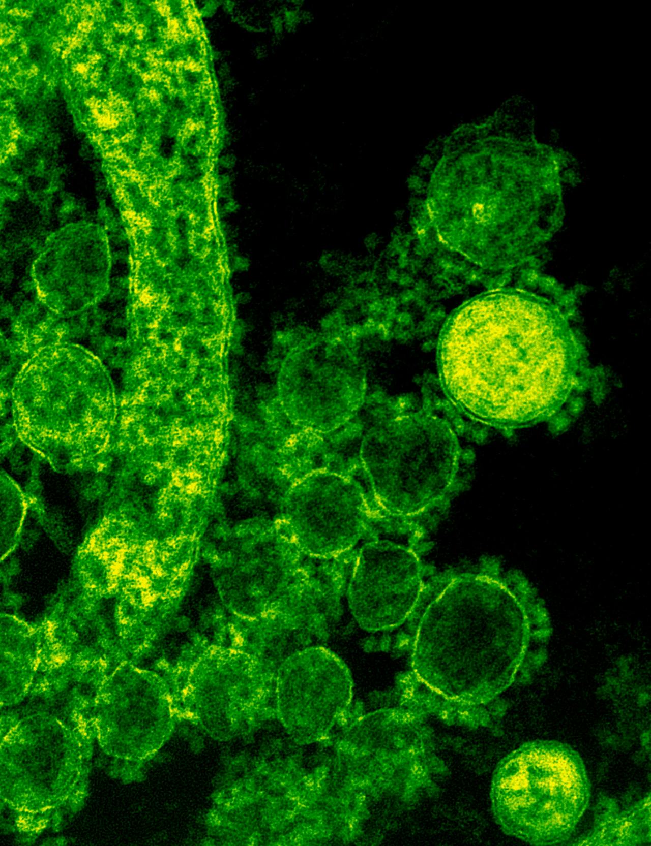 The Role of Probiotics in Comprehensive Health